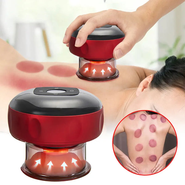 Electric Vacuum Cupping Massage